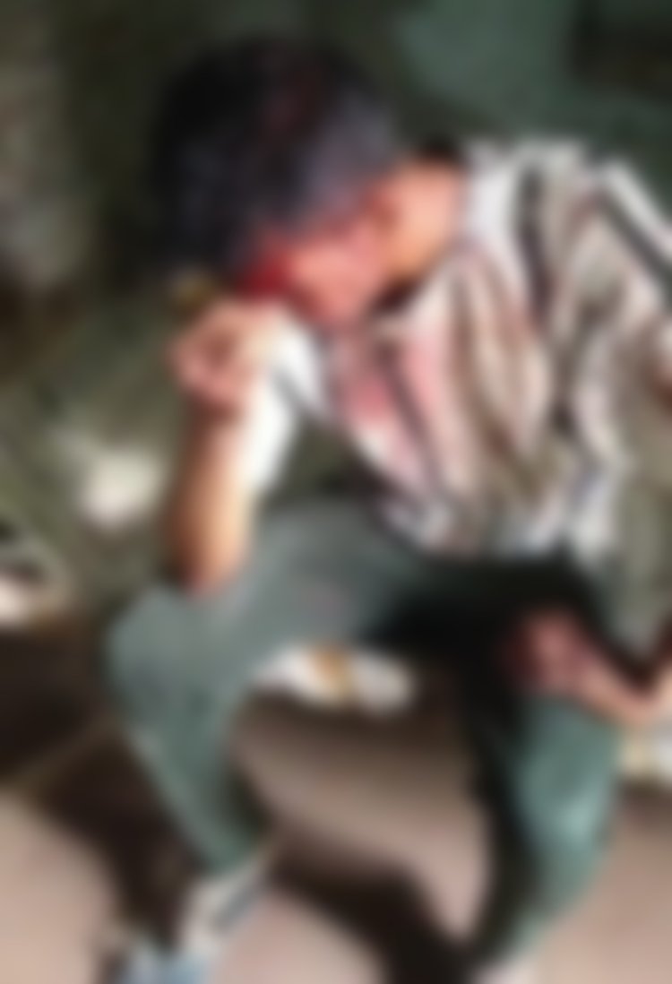 बहन के साथ छेड़खानी का विरोध करने पर युवक पर धारदार हथियार से हमला कर किया लहूलुहान, दी तहरीर