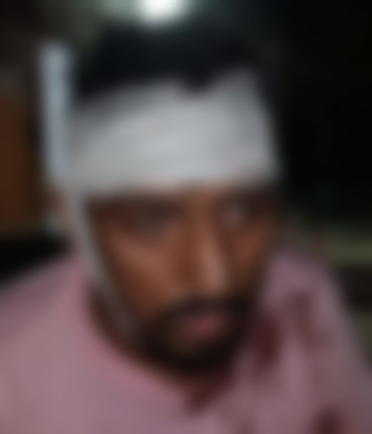 हसनपुर मसूरी से बाजार में आए युवक पर हमला , किया घायल 